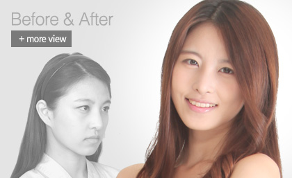 �������Ļ���