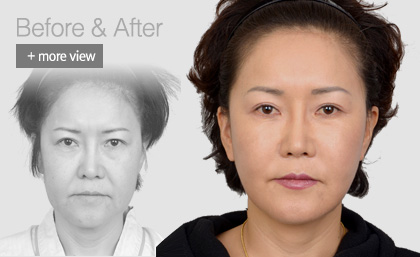 �������Ļ���